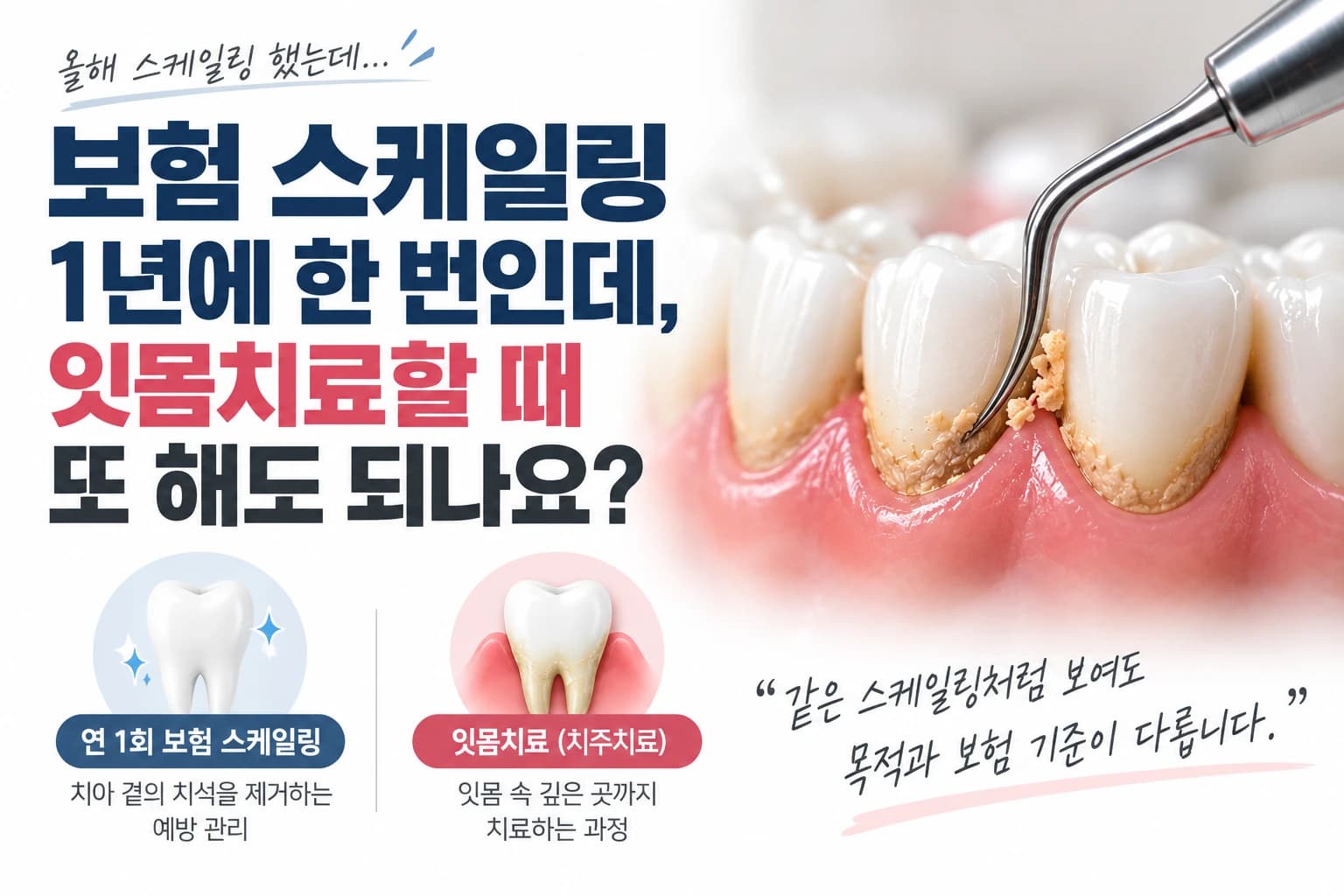 보험 스케일링과 잇몸치료 기준을 설명하는 원문 요약 이미지