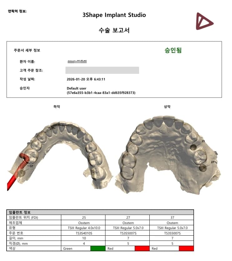 수술 가이드와 식립 위치를 계획한 원문 수술 보고서
