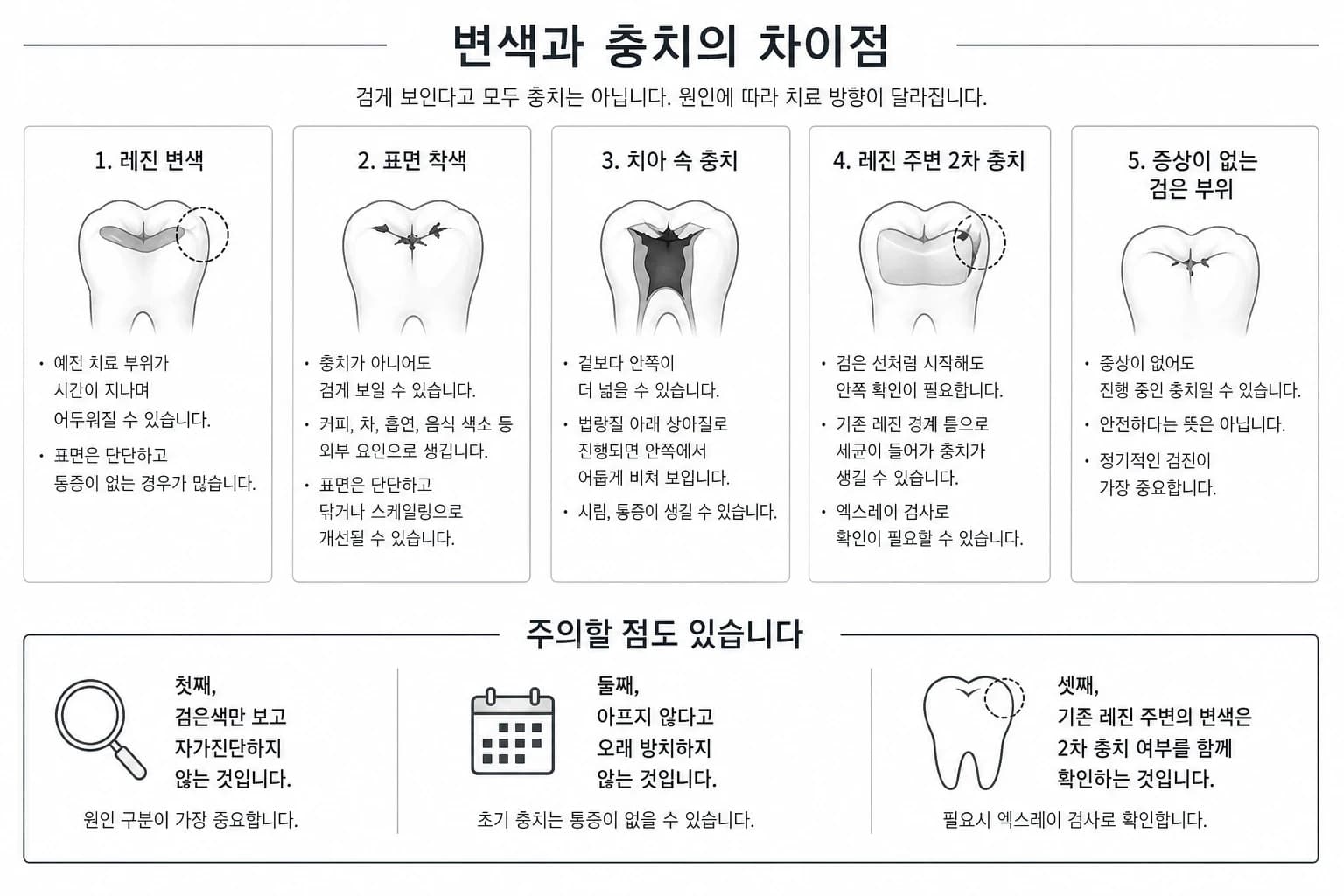 변색과 충치의 차이 및 검진 필요성을 정리한 원문 교육 그림