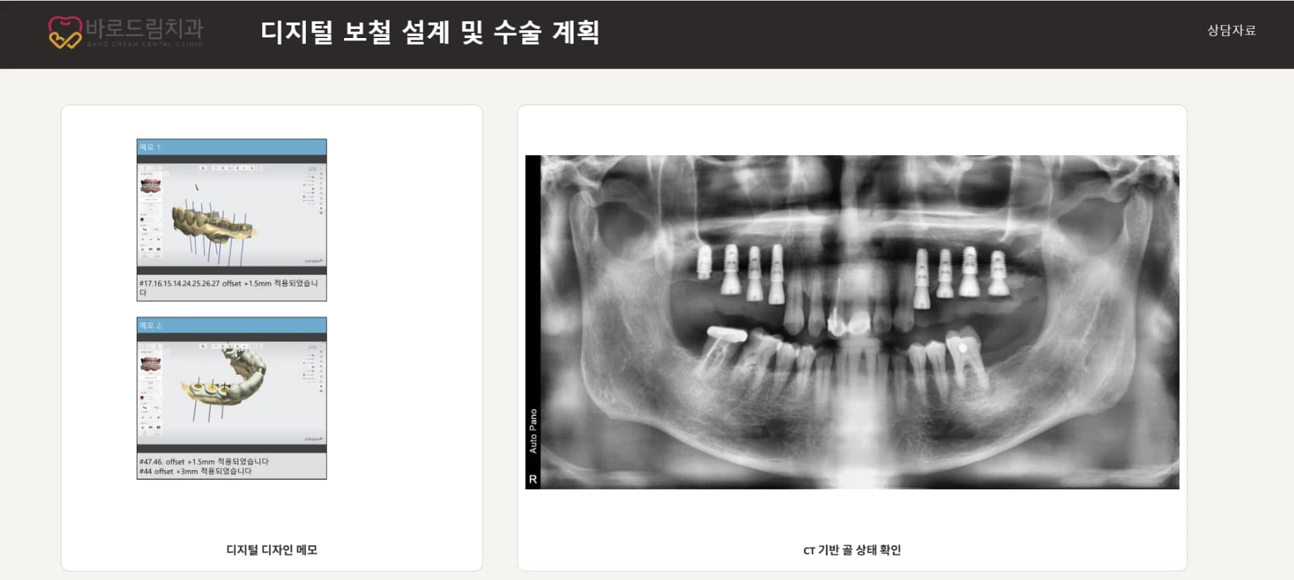 디지털 보철 설계 화면과 식립 후 파노라마를 함께 배치한 원문 상담 자료