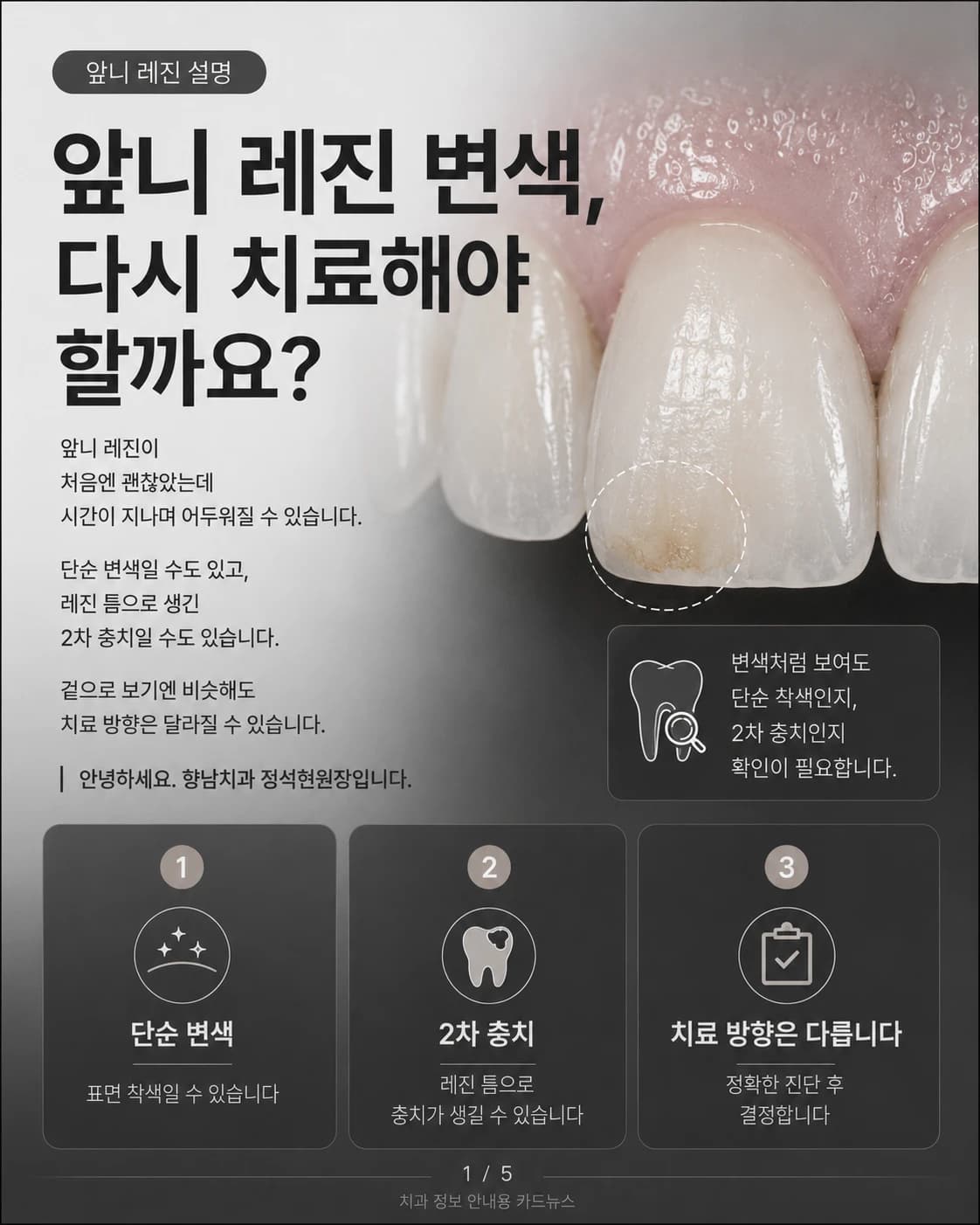 앞니 레진 변색과 치료 판단을 정리한 원문 교육 이미지