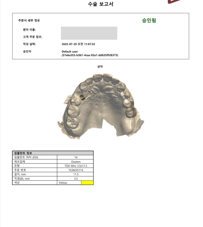 임플란트 식립 위치와 규격을 계획한 수술 보고 자료