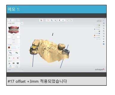 원문에 제시된 임플란트 보철 설계 메모 화면