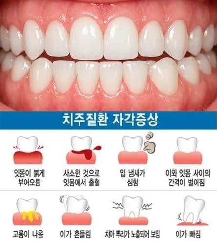 잇몸 출혈과 치아 흔들림 등 치주질환 증상을 설명한 자료